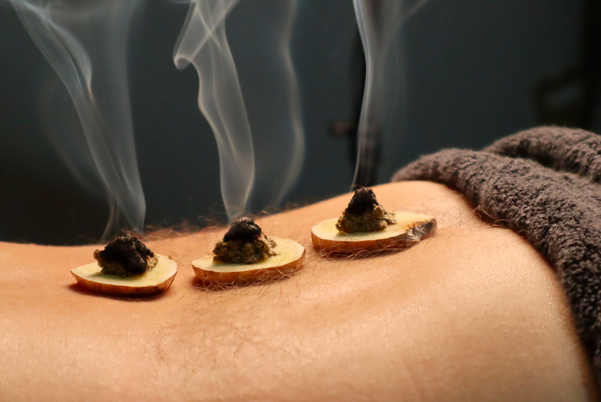 Moxibustion traditionnelle